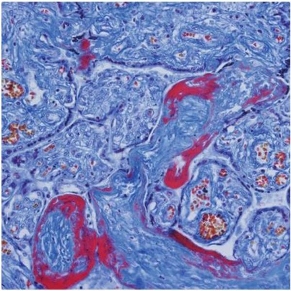 Evident Olympus Microscoop CX41 Hematologie, trino, Hal, 40x, 500x, 1000x