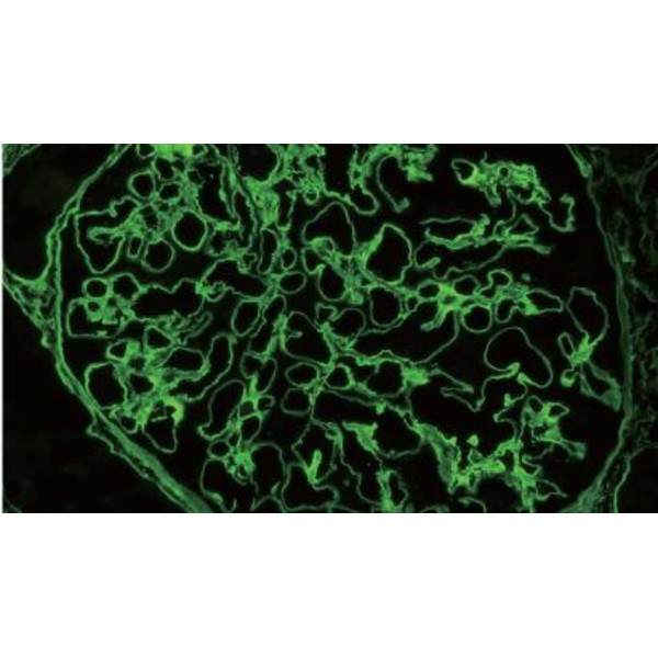 Evident Olympus Microscoop Olympus CX43 Ergo, bino, infinity, LED, ohne Objektive!