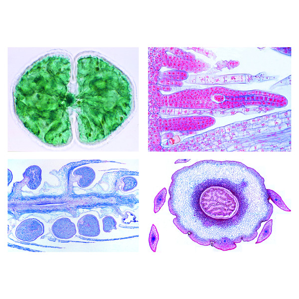 LIEDER Cryptogamae, supplementary set II, 25 microscope slides