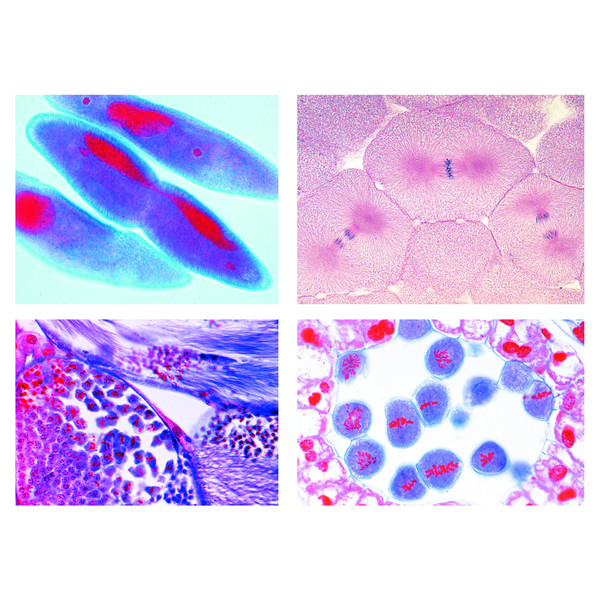 LIEDER Mitosis and Meiosis Set II, 5 selected microscope slides