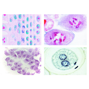 LIEDER Mitosis and Meiosis Set I, 6 selected microscope slides