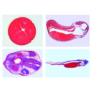LIEDER The Frog Embryology (Rana sp.), 10 microscope slides