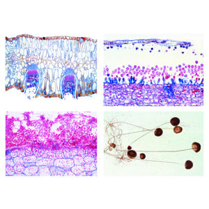 LIEDER Agriculture and Forestry, Part I. Harmful fungi as the cause of plant diseases. 20 prepared microscope slides