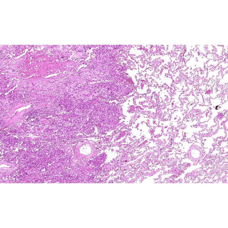 Lumenera Cámara INFINITY2-2C, CCD, color, 2.0 MP