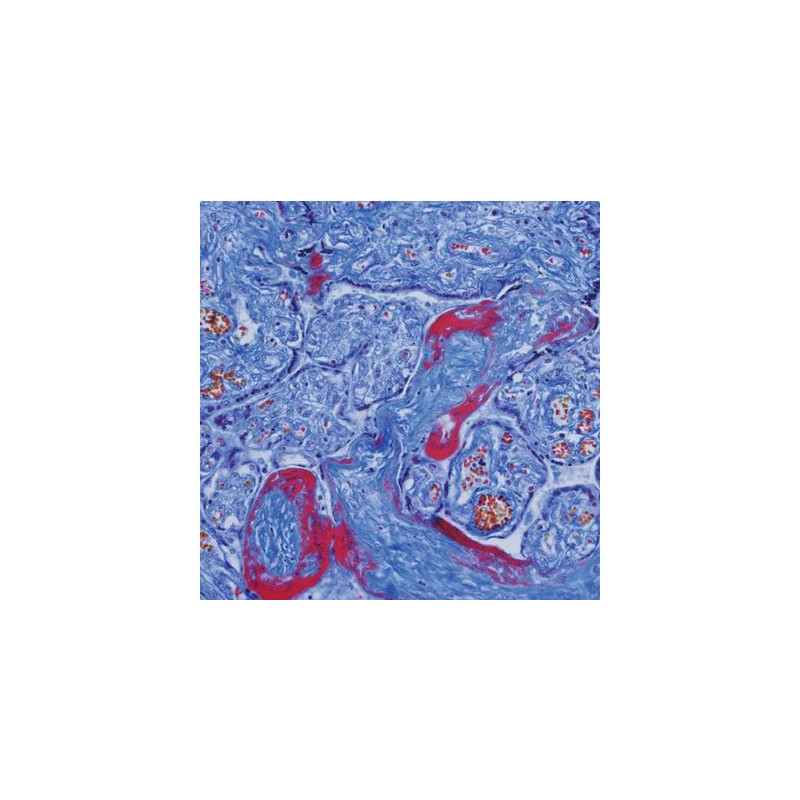 Evident Olympus Microscoop CX41 Hematologie, trino, Hal, 40x, 500x, 1000x