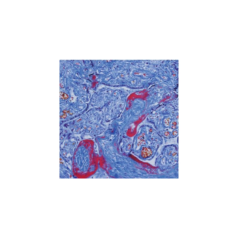 Evident Olympus Microscope CX41 Pathology, trino, halogen, 40x,100x, 400x,