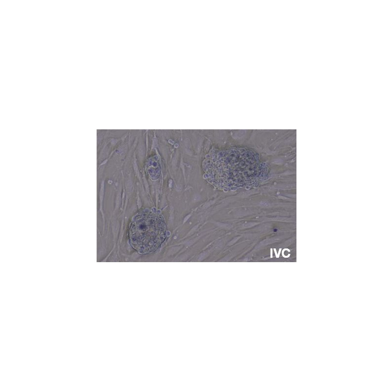 Evident Olympus Omgekeerde microscoop Olympus CKX53 met tafelaandrijving, trino, infinity, plan achro, LED, zonder Lenzen!