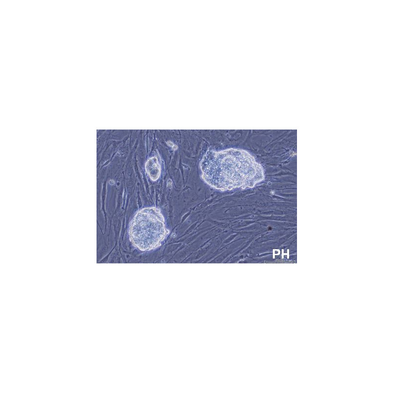 Evident Olympus Omgekeerde microscoop Olympus CKX53 met tafelaandrijving, trino, infinity, plan achro, LED, zonder Lenzen!
