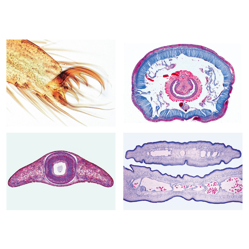 LIEDER Invertebrata, elementary set, 25 microscope slides