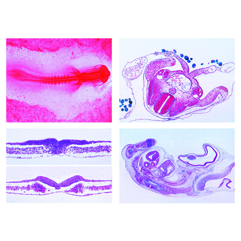 LIEDER The Chicken Embryology (Gallus domesticus), 10 microscope slides