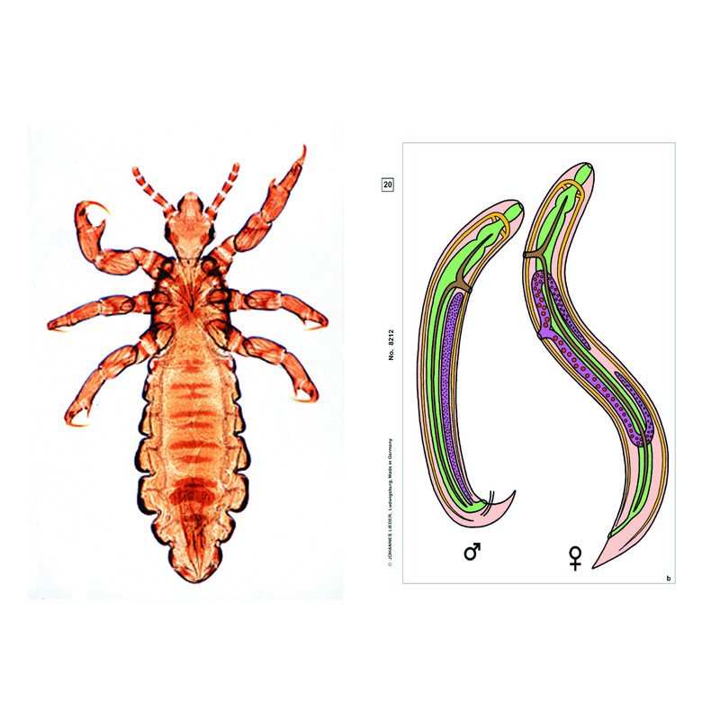 LIEDER Parasites of man and animals, Supplementary Set of 12 slides,  Student Set