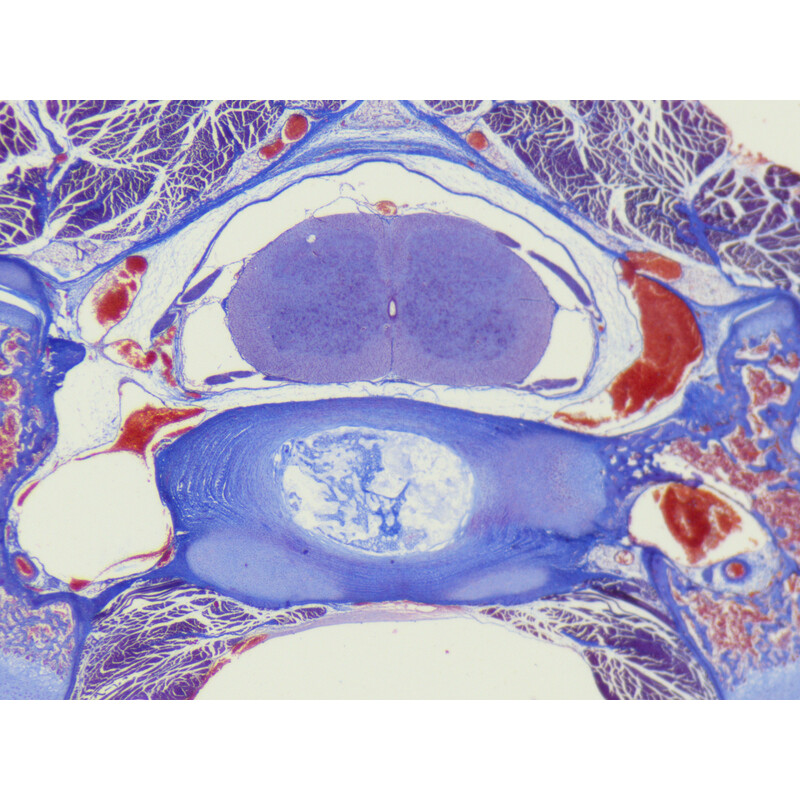 ZEISS Stemi 355 stereo zoom microscope, C Edu, trino, w.d. 110 mm, 10x/23, 5.5:1, 7.2x–40x, AL/DL, Spot C LED